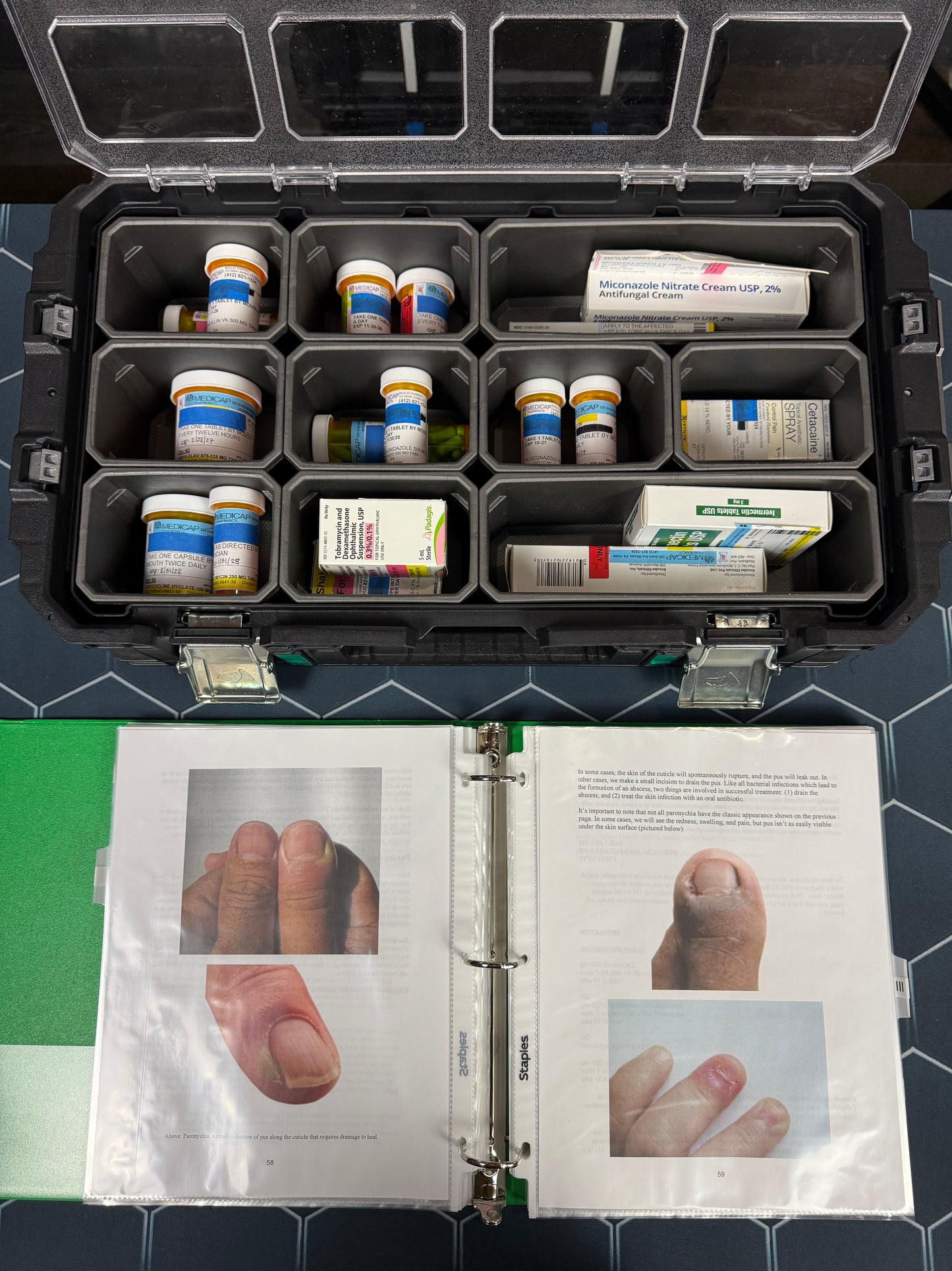 S.T.A.C.K. SYSTEM SINGLE TREATMENT MODULE: INFECTION